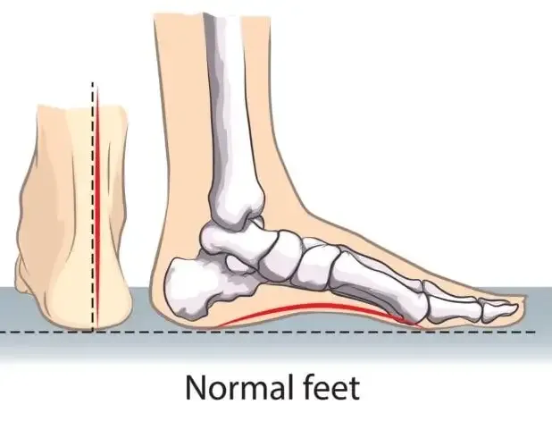 Illustration of a normal foot from behind and from the side, with the heel upright and the arch raised