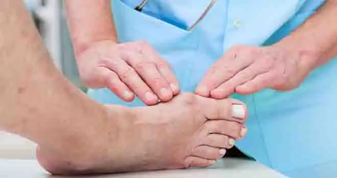 Bunion Treatment