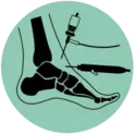Ankle Arthroscopy